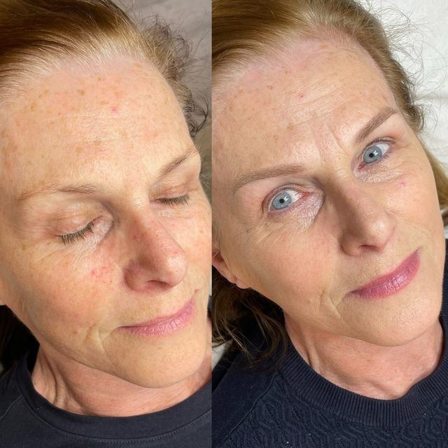 Brows before and after semi-permanent makeup, healed after 2 months