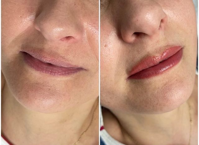 Before and after lip blush